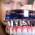 Transform Your Smile With Teeth Implants: Finding The Best Dental Implants Dentist In Pflugerville, TX