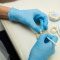 Complete Your Smile: Exploring Teeth Implants In Edmonds