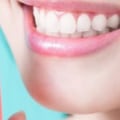 Smile With Confidence: Exploring Teeth Implants In Gainesville, VA